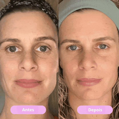 Luminesce™ - 7-in-1 LED Facial